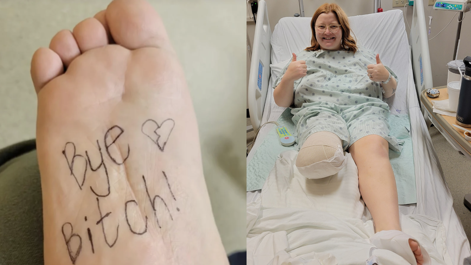 Ende der Schmerzen: Jahrelang lebte : Sierra Diller mit einem Tumor im Fuß. 