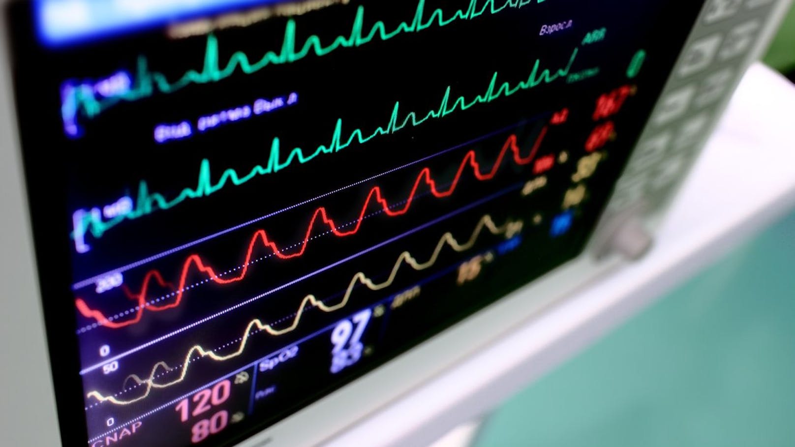 Das sind die Anzeichen für einen baldigen Tod Gesundheit heute.at Das sind die Anzeichen für einen baldigen Tod Gesundheit heute.at