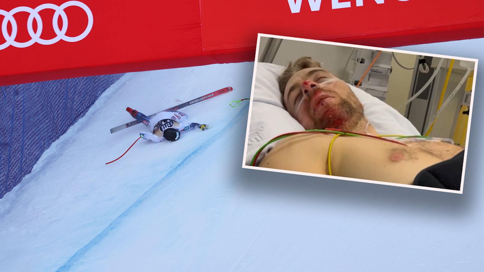 Ski-Star Kilde nach schwerem Sturz wieder operiert
