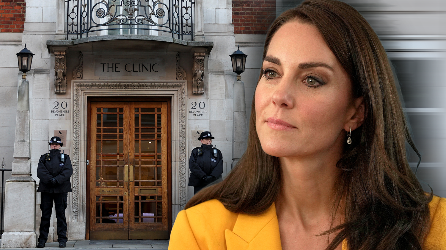 Prinzessin Kate musste operiert werden.