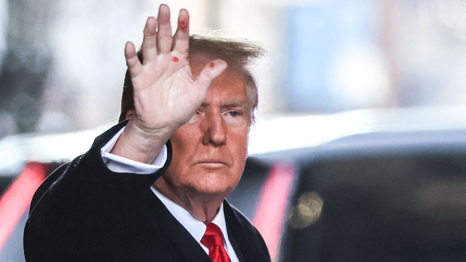 Mysteriöse Flecken an Trumps Hand erzeugen Spekulation