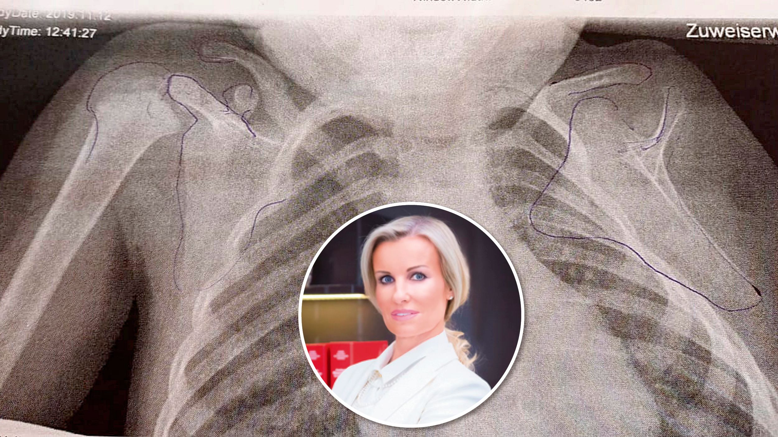 Karin Prutsch-Lang erkämpfte Ansprüche für Mutter von schwer behindertem Mädchen (5). Der Arzt habe vor der Geburt Fehler gemacht.