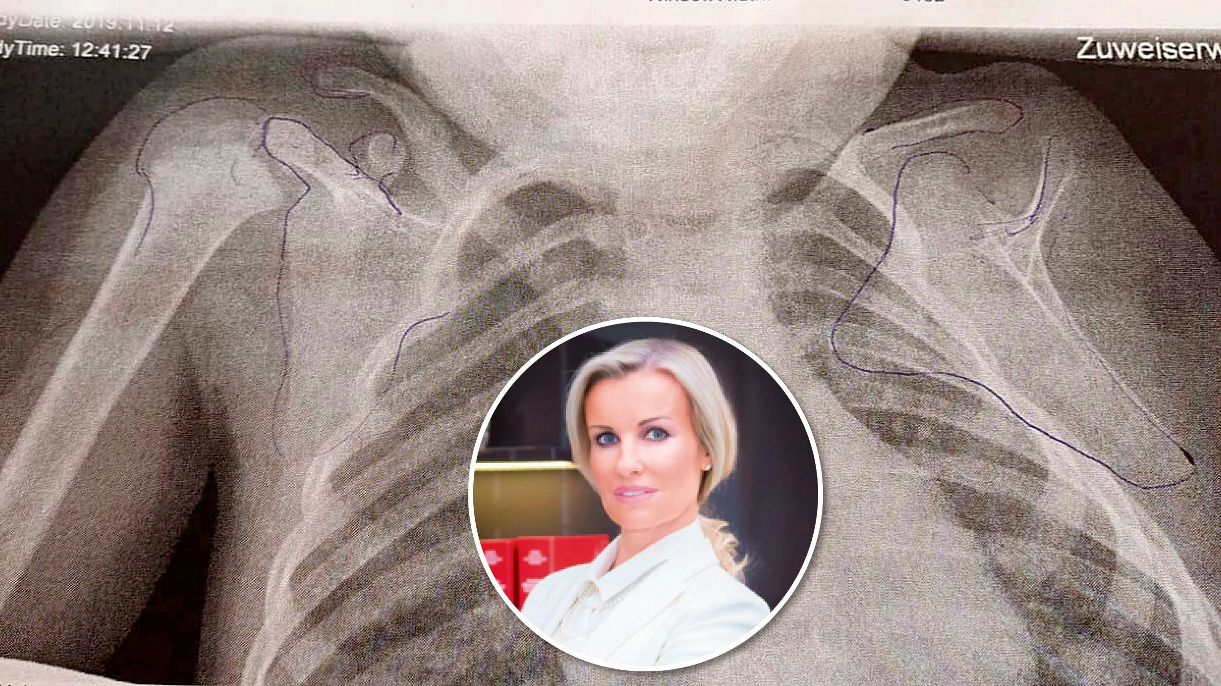 Karin Prutsch-Lang erkämpfte Ansprüche für Mutter von schwer behindertem Mädchen (5). Der Arzt habe vor der Geburt Fehler gemacht.