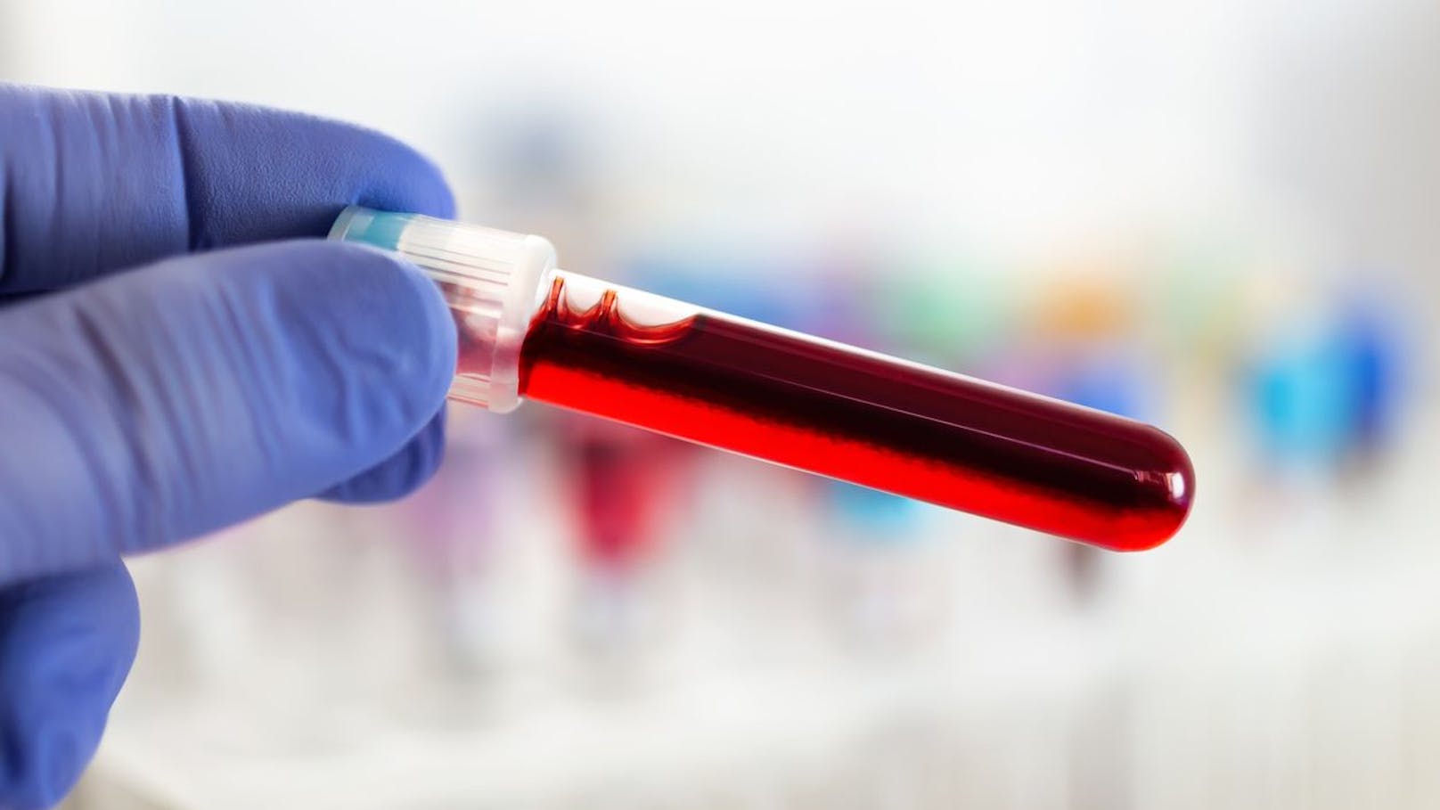 Nachweis im Blut gefunden: Gibt's bald Long-Covid-Test?