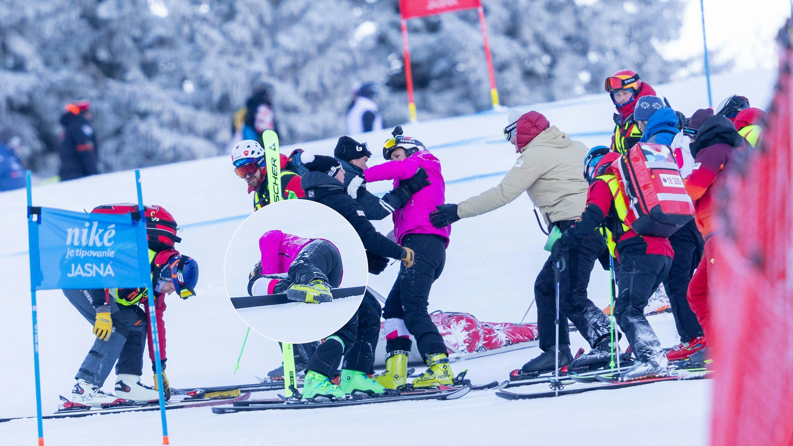 Heute.at - Sturz bei ORF-Kamerafahrt: Hosp erneut operiert