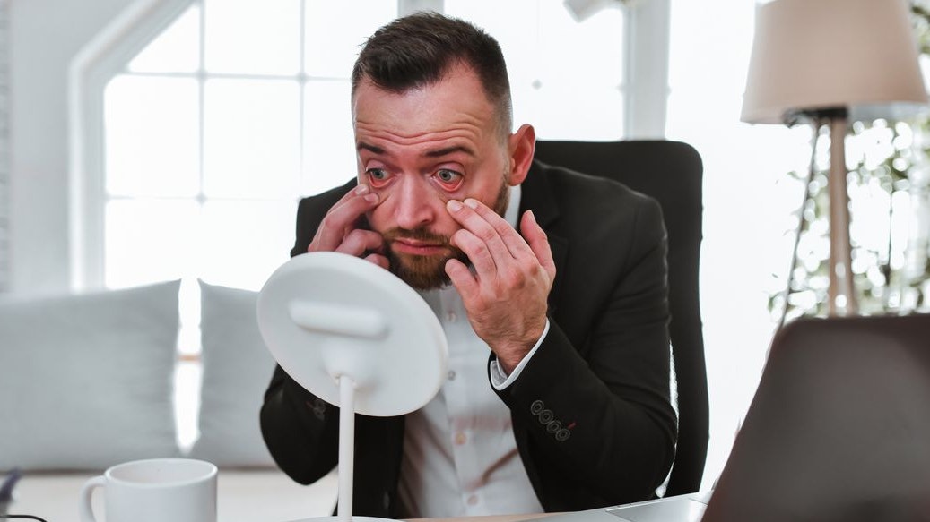 Tired Businessman Checking Bloodshot Eyes In Mirror Before Video Conference