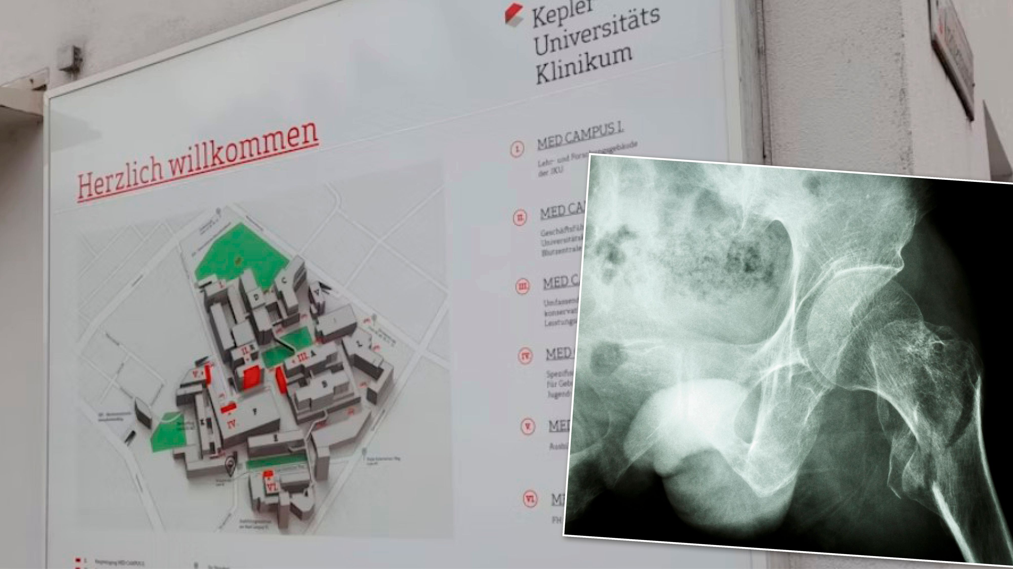 Die Frau wurde mit Verdacht auf einen Oberschenkelhalsbruch ins Krankenhaus gebracht.