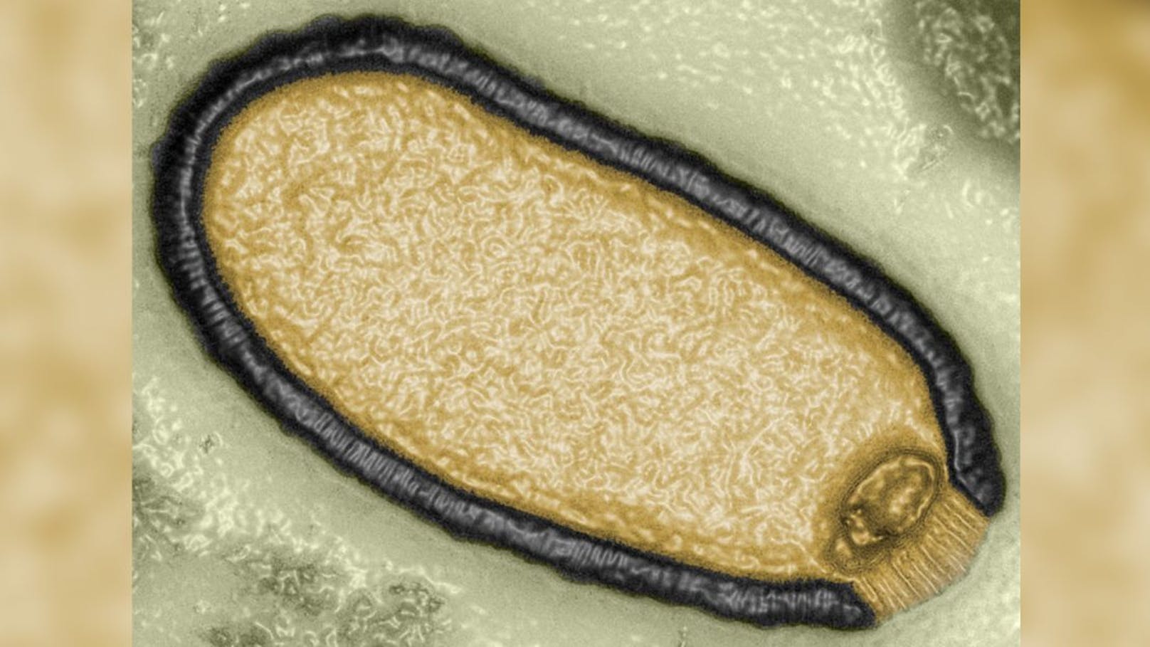 "Zombieviren" – Forscher warnen vor neuer Pandemie