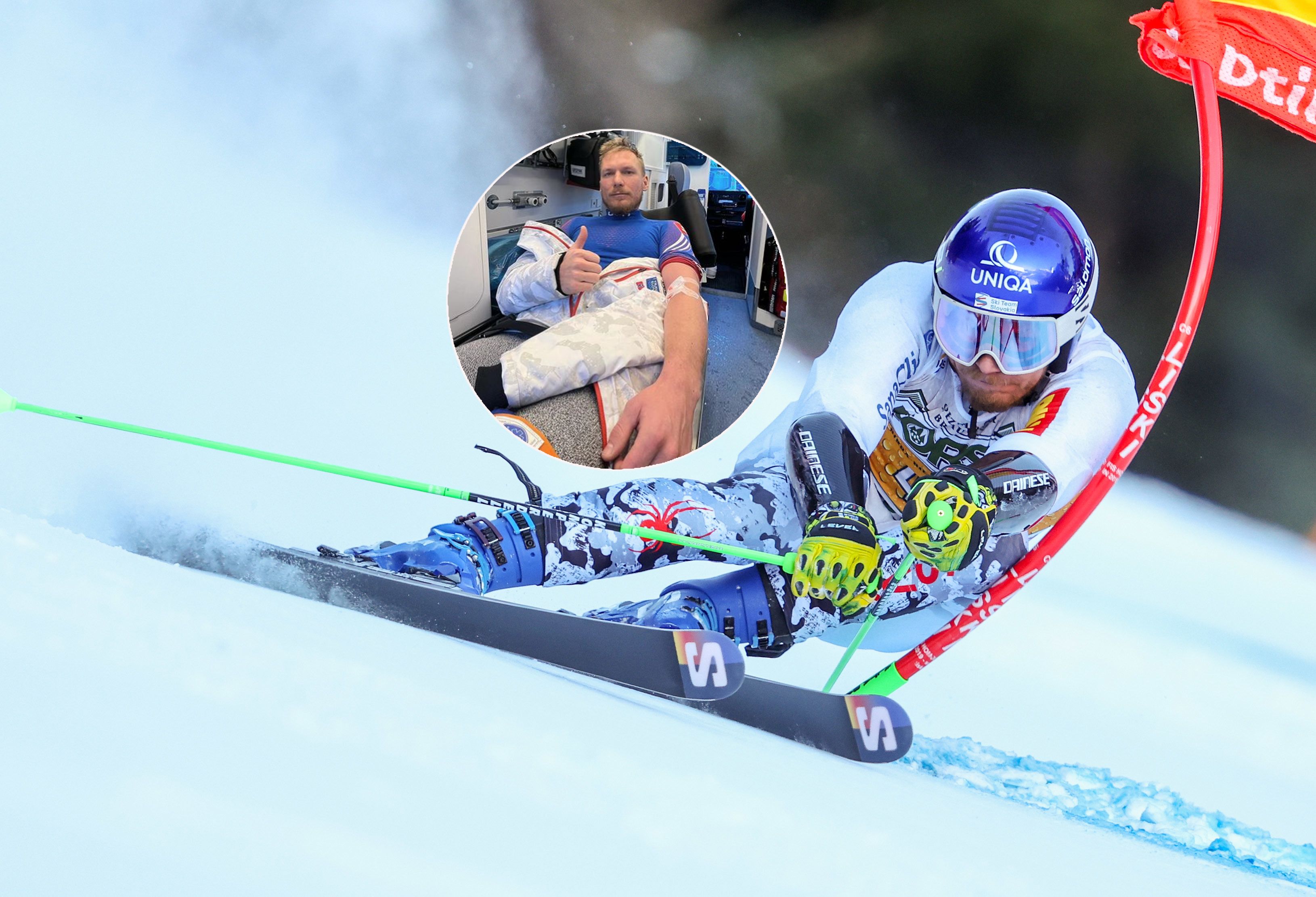 Adam Zampa verletzte sich als Damen-Vorläufer.