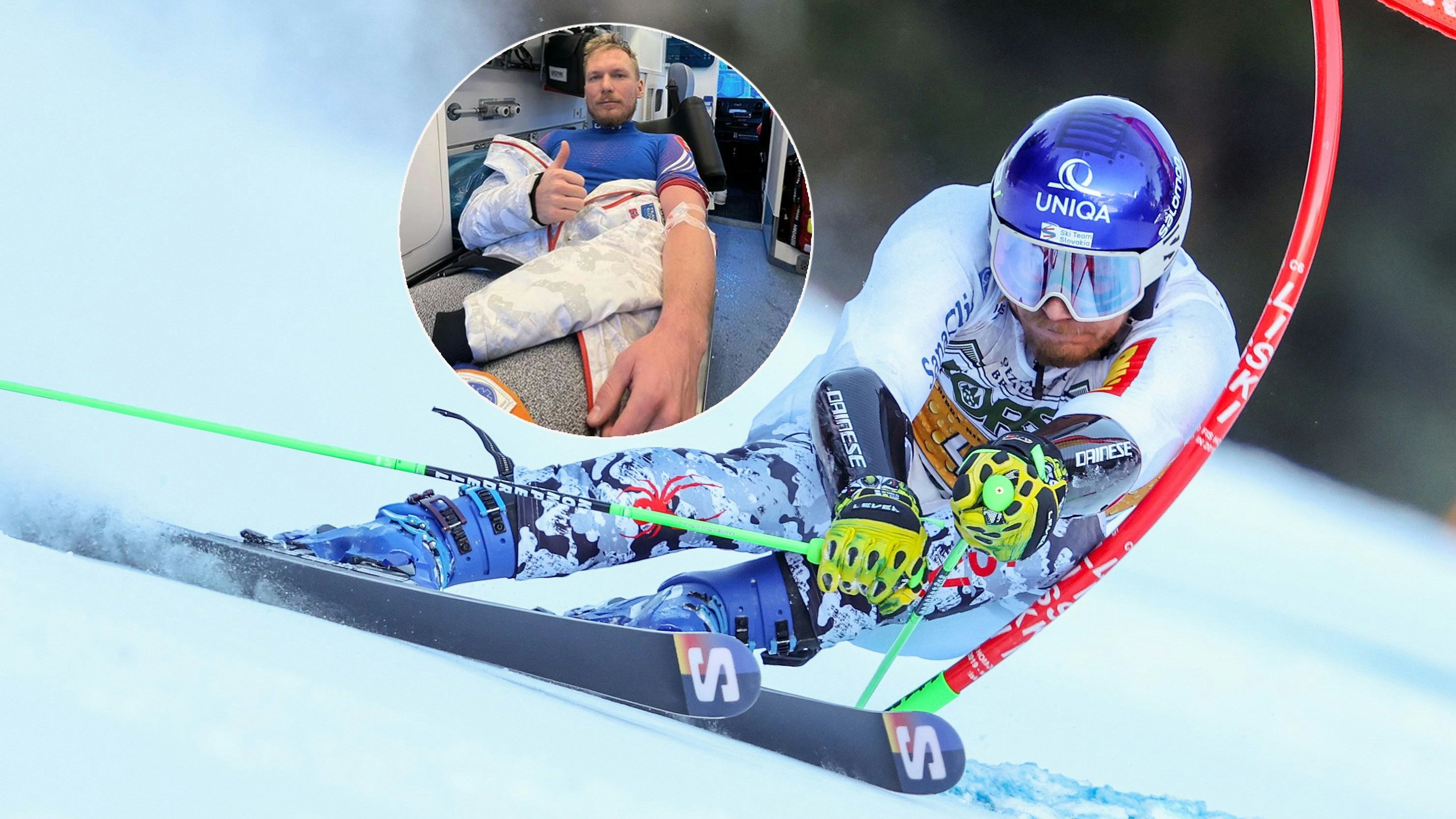 Adam Zampa verletzte sich als Damen-Vorläufer.