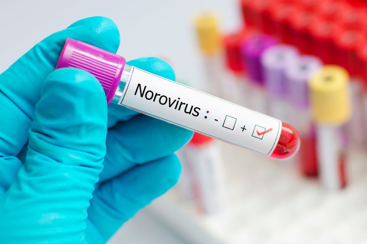 Insgesamt 144 Lokalgäste klagen über Symptome, die auf das Norovirus hindeuten.