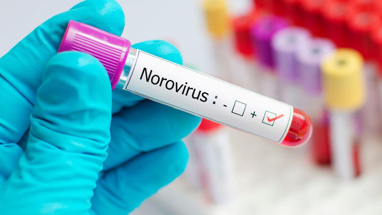 Das <strong>Norovirus</strong> ist ein hochansteckendes Virus, das Brechdurchfall verursacht. Es genügen weniger als 100 Partikel, um krank zu machen. Betroffene scheiden Milliarden über ihren Stuhl und Erbrochenes aus. Da es sich in der Luft befindet, kann man sich durch Einatmen der Partikel infizieren, aber auch durch infizierte Lebensmittel und Wasser sowie kontaminierte Oberflächen.