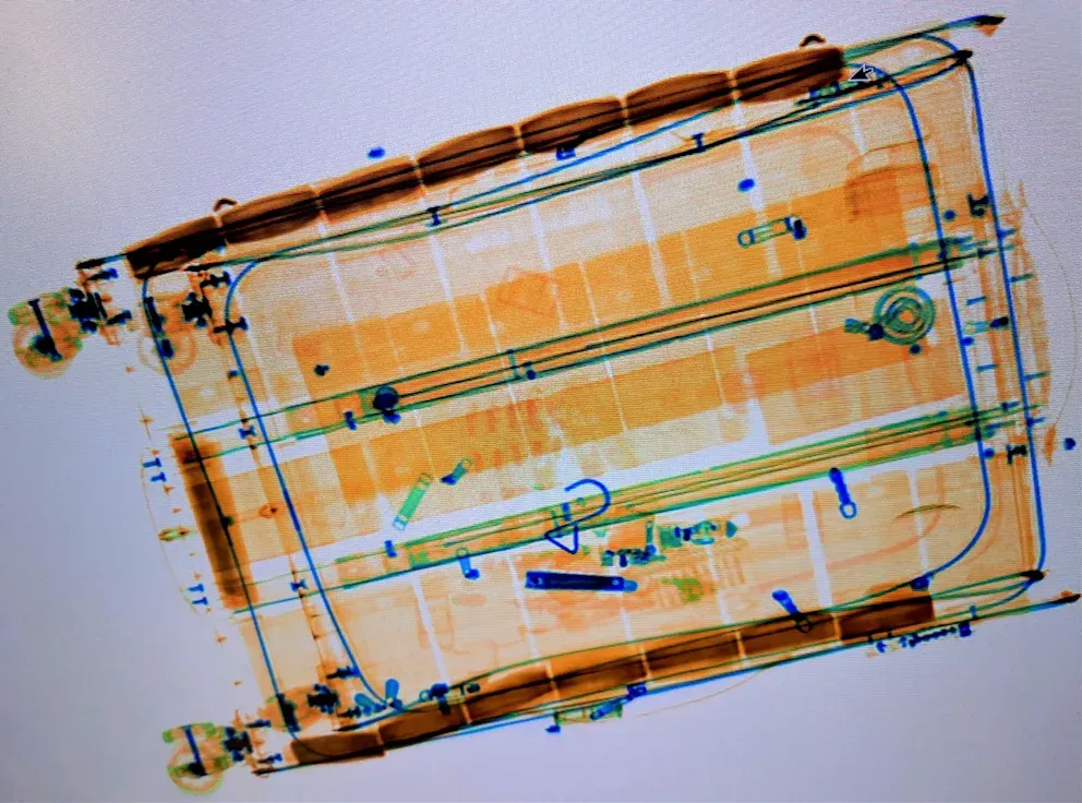 Auf den Röntgenaufnahme sieht man die Scheine deutlich. Damit hatte der Schmuggler scheinbar nicht gerechnet.