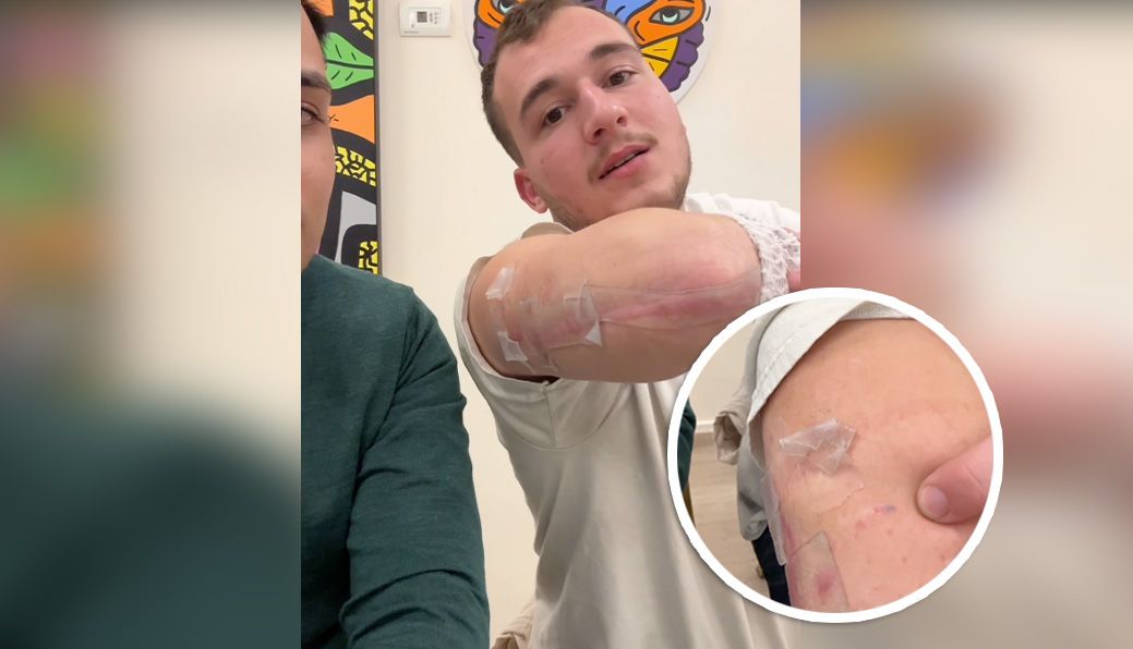 Tomer hält seinen verletzten Arm in die Kamera. Kugelteile aus den Kalaschnikows der Hamas-Terroristen stecken ihm noch unter der Haut.