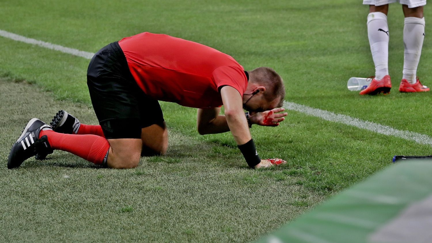 Fredrik Klyver wurde 2018 von einem Becher am Kopf verletzt. 