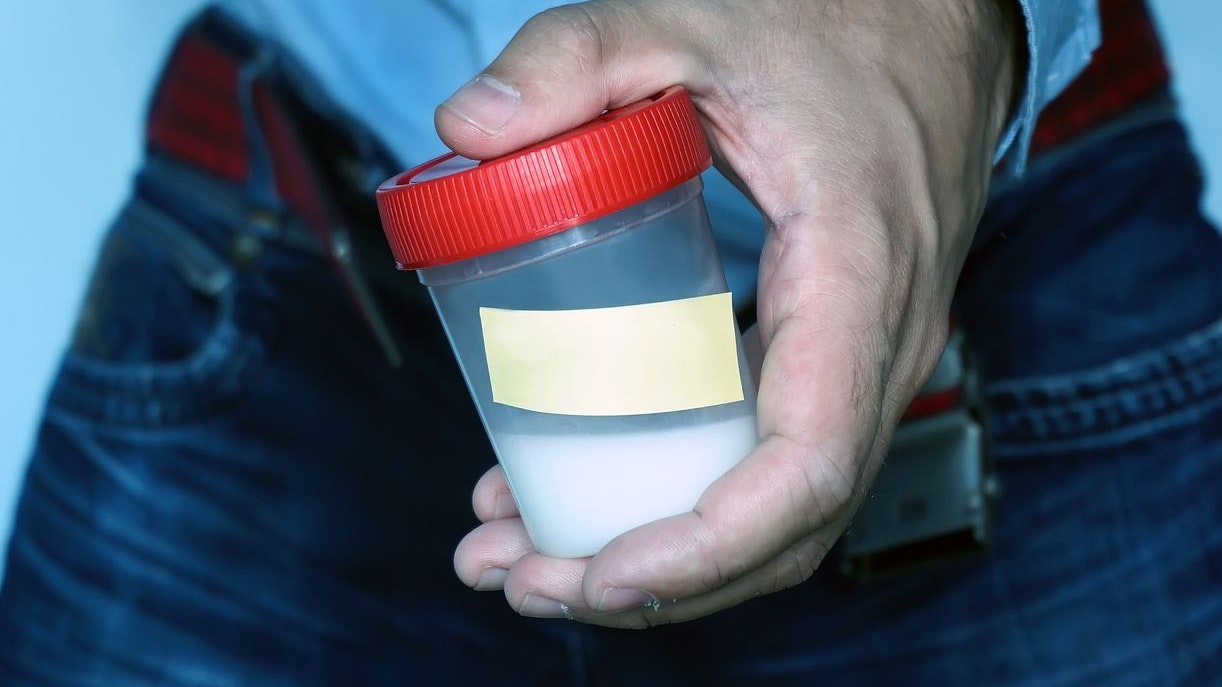 a sperm donor with a jar to collect the tests in hand. close-up semen in left hand of man. with copy space for your text