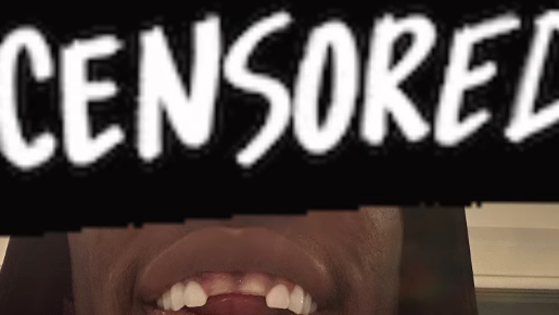 Auf Instagram zeigte Barry die fehlenden Zähne.