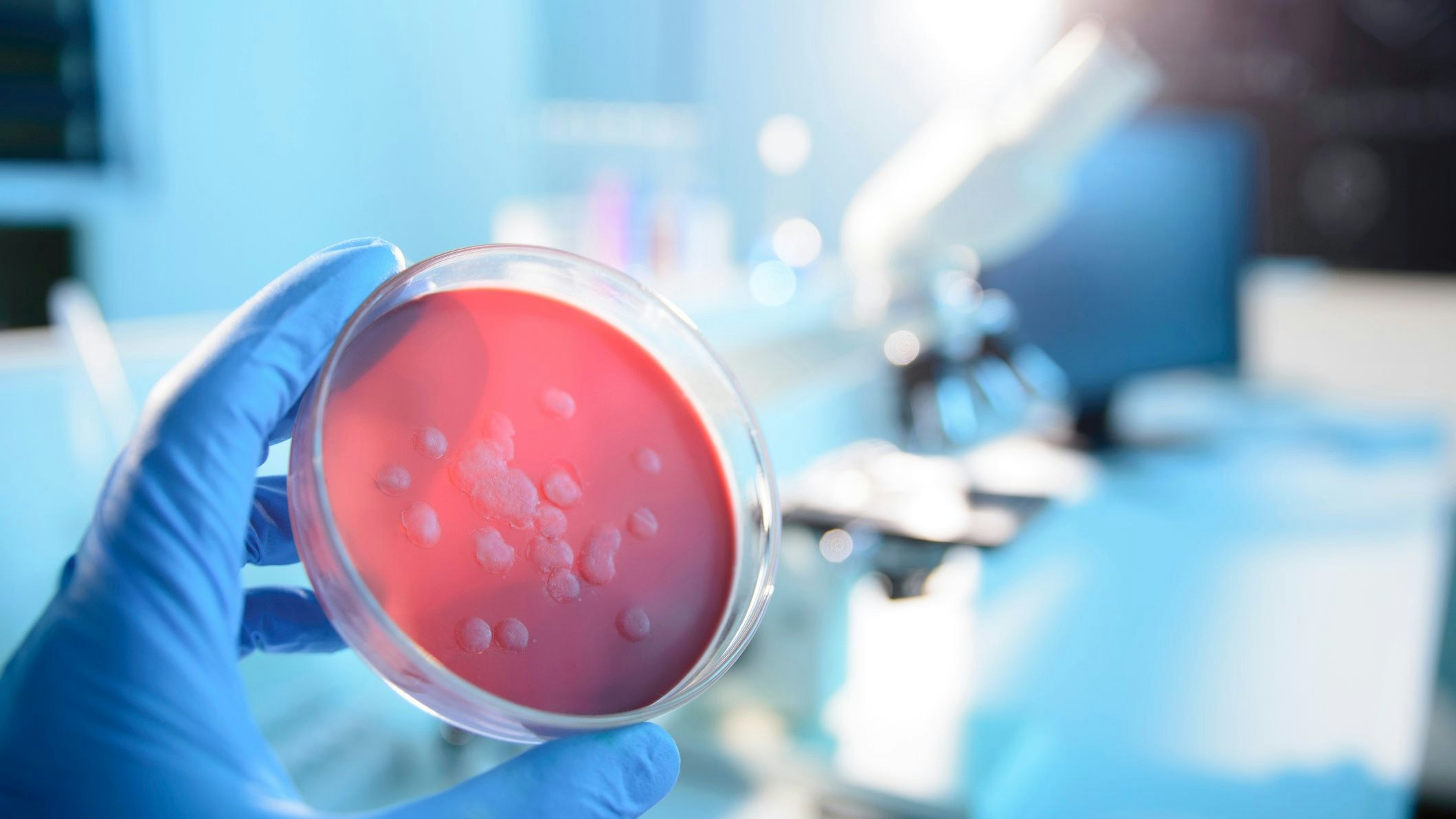 In zwei Flüssen wurden die antibiotikaresistenten Bakterien nachgewiesen.