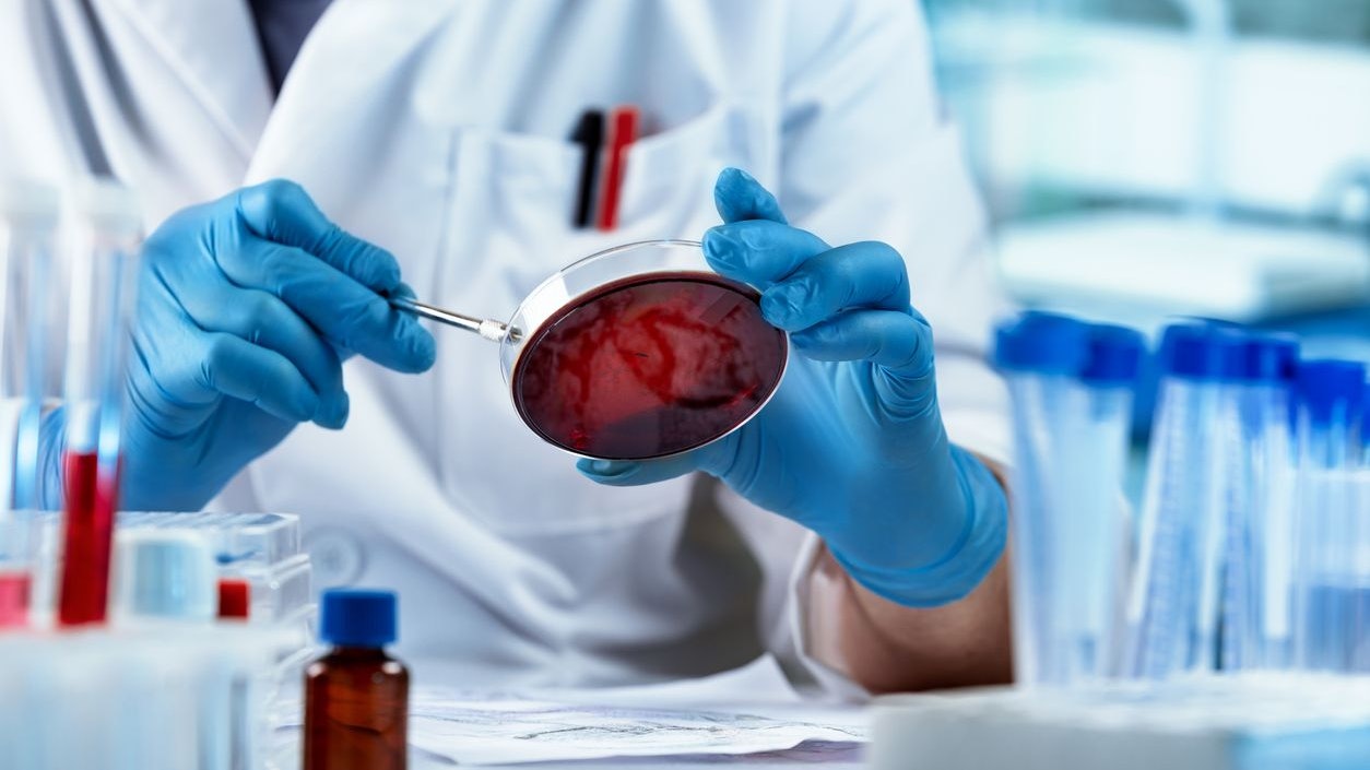 Die Zahl der mit dem Norovirus infizierten Personen in Salzburg hat sie fast verdoppelt.