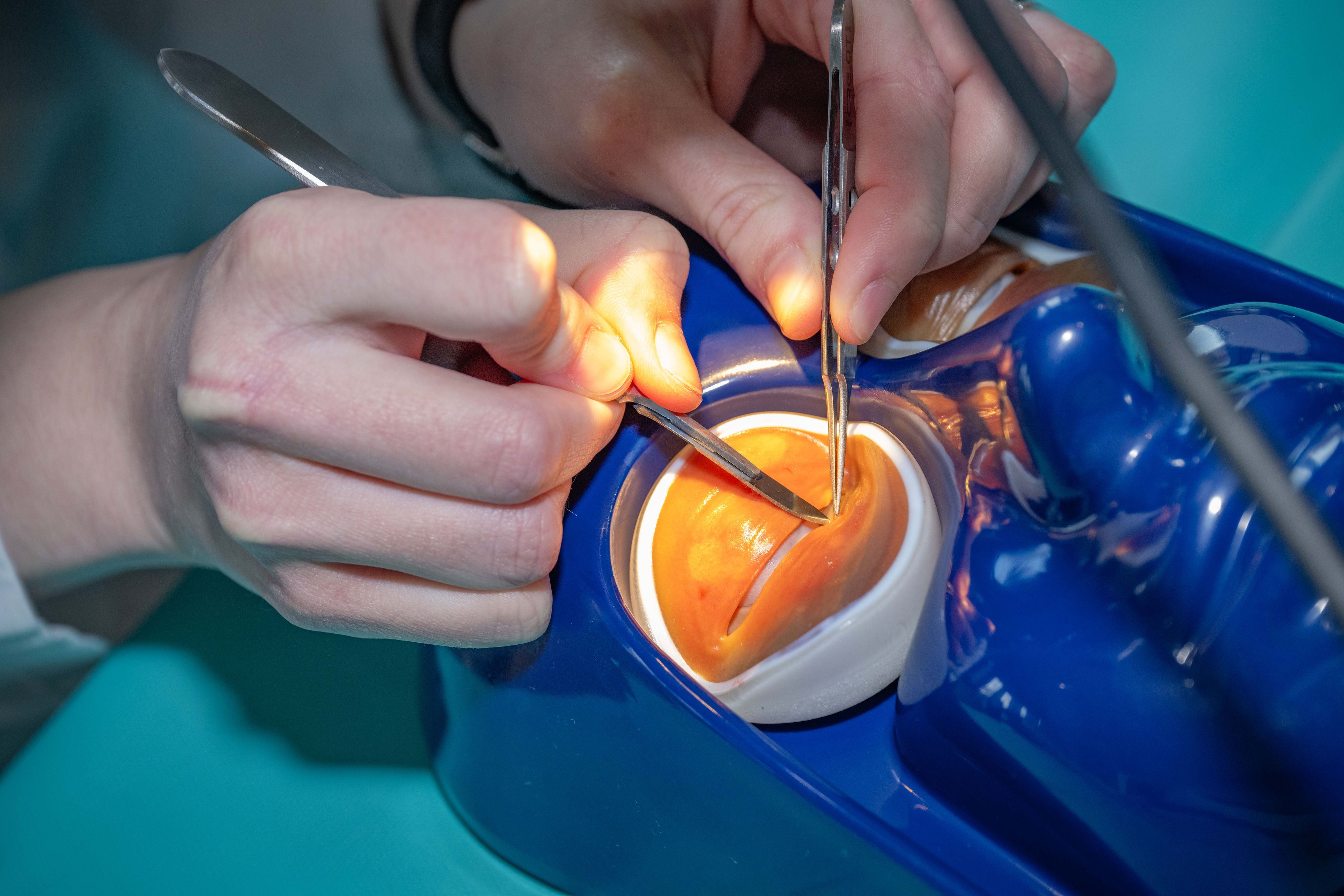 Die 3D-gedruckten Augen-Modelle sollen so realitätsnah wie möglich sein.