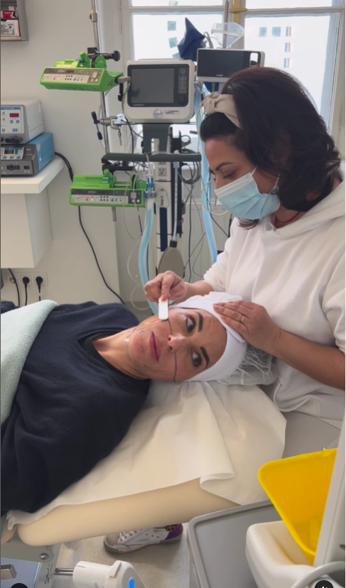 Elke Rock probierte eine neue Methode des Faceliftings aus