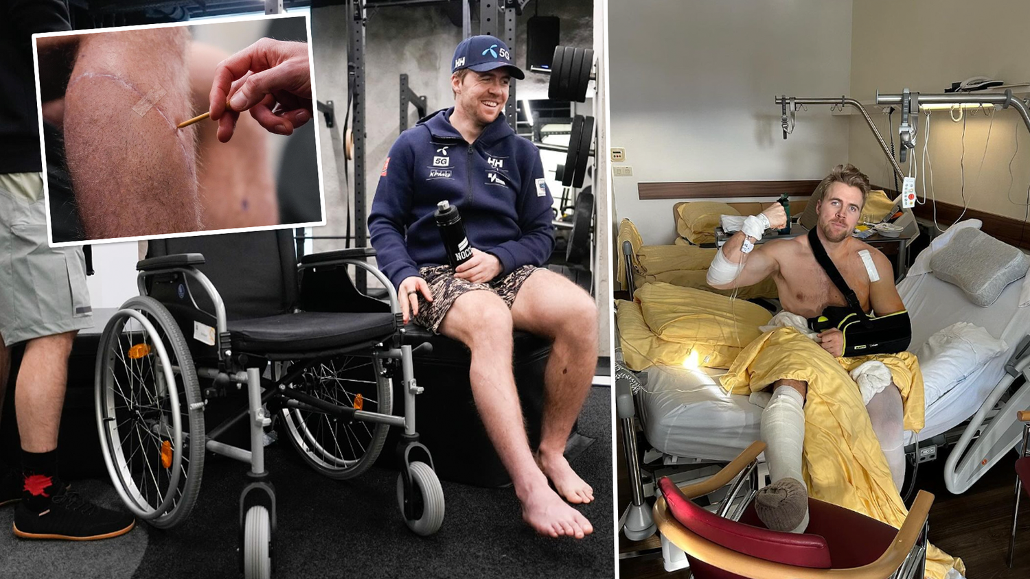 Der norwegische Ski-Star Aleksander Aamodt Kilde ist auf dem Weg zurück.