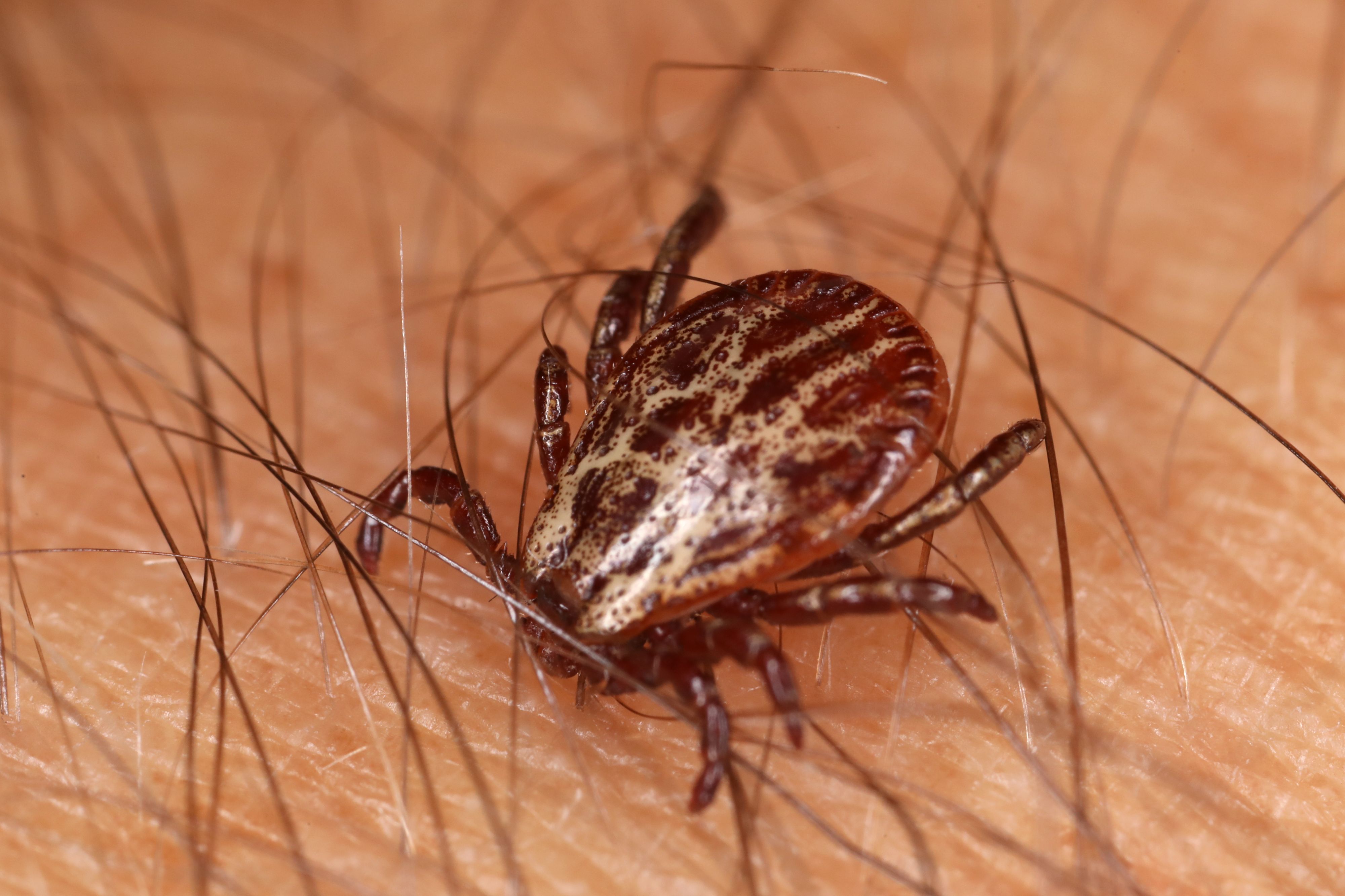 Download von www.picturedesk.com am 14.03.2024 (15:15).  11.10.2019, Berlin, Deutschland, Auwaldzecke auf menschlicher Haut. 00S191011D533CARO.JPG [MODEL RELEASE: NO, PROPERTY RELEASE: NO (c) caro images / Frank Sorge - 20191011_PD19292 - Rechteinfo: Rights Managed (RM)