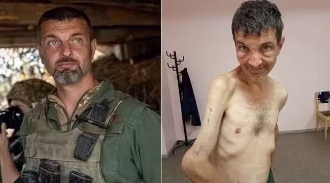 Wie schlecht Russland die ukrainischen Kriegsgefangenen behandelt, zeigt der Fall von Mykhailo Dianow. Der Ukrainer kam nach mehreren Monaten in russischer Haft im September 2022 frei.