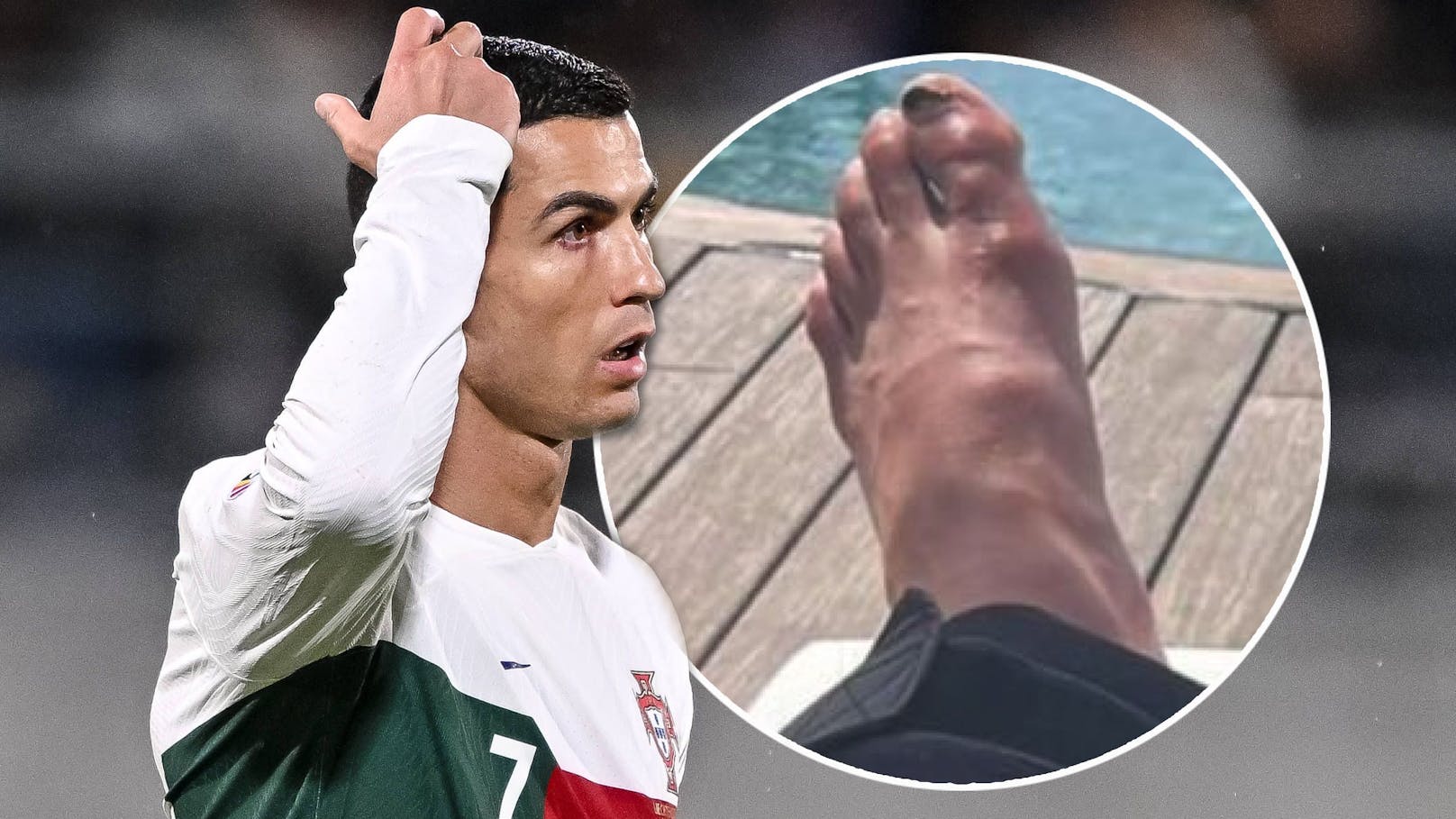 Fans sorgen sich um Beulen-Füße von Ronaldo