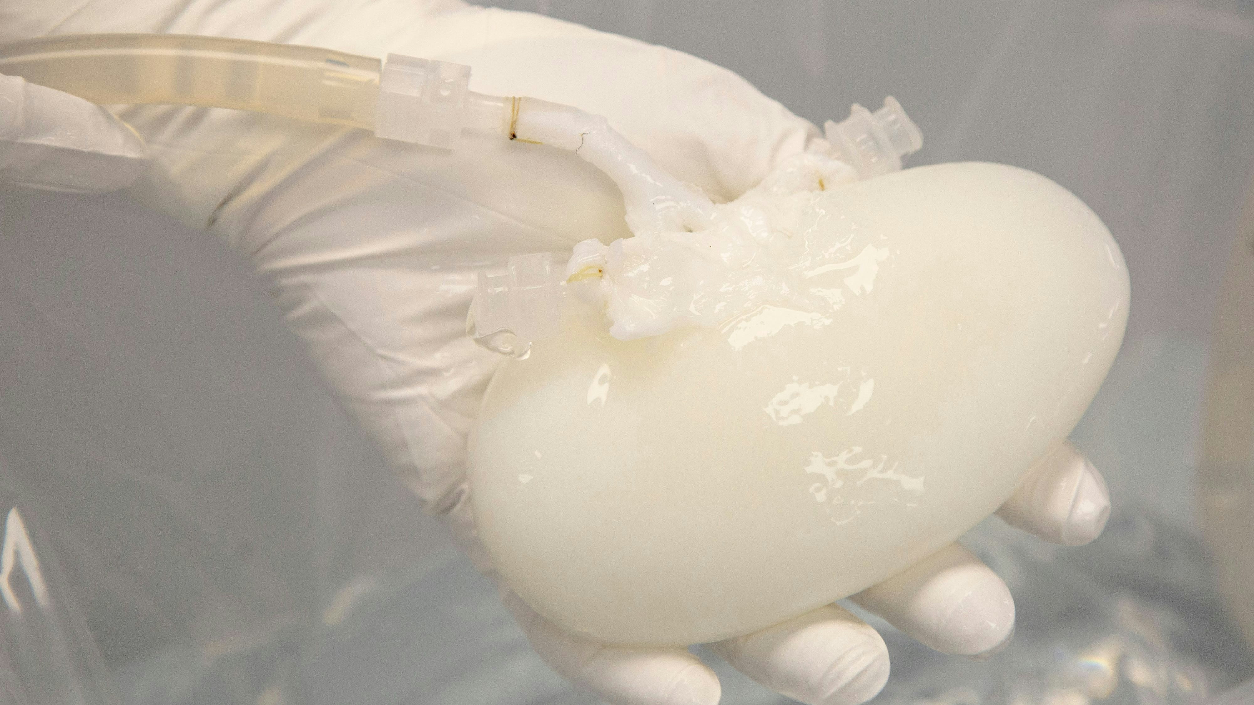 Download von www.picturedesk.com am 21.03.2024 (15:37).  A pig kidney that has been "decelled" is held by a technician in a Micromatrix laboratory on Tuesday, Dec. 8, 2022, in Eden Prairie, Minn. This is a pig kidney that's gradually being transformed to look and act like a human one, part of scientists' long quest to ease the nation's transplant shortage by bioengineering replacement organs. (AP Photo/Andy Clayton-King) - 20221208_PD16739 - Rechteinfo: Rights Managed (RM)