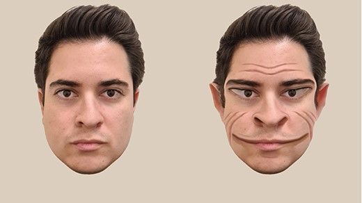 In der medizinischen Literatur sind nur 75 Fälle der 