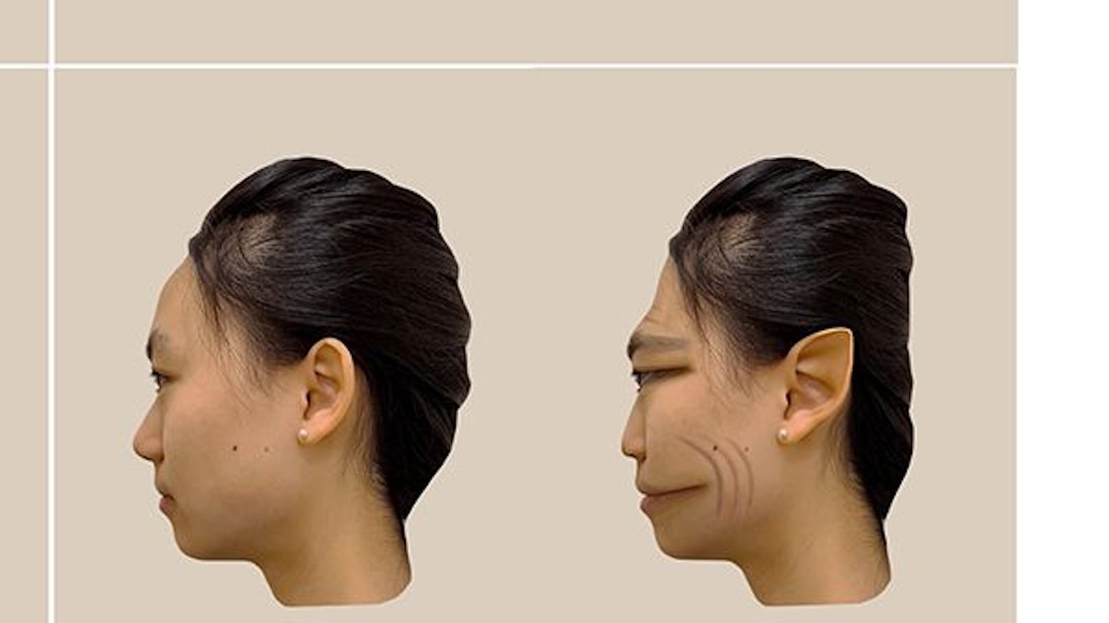 Erstmals konnten die PMO-Gesichtverzerrungen bildlich festgehalten werden (Bild).