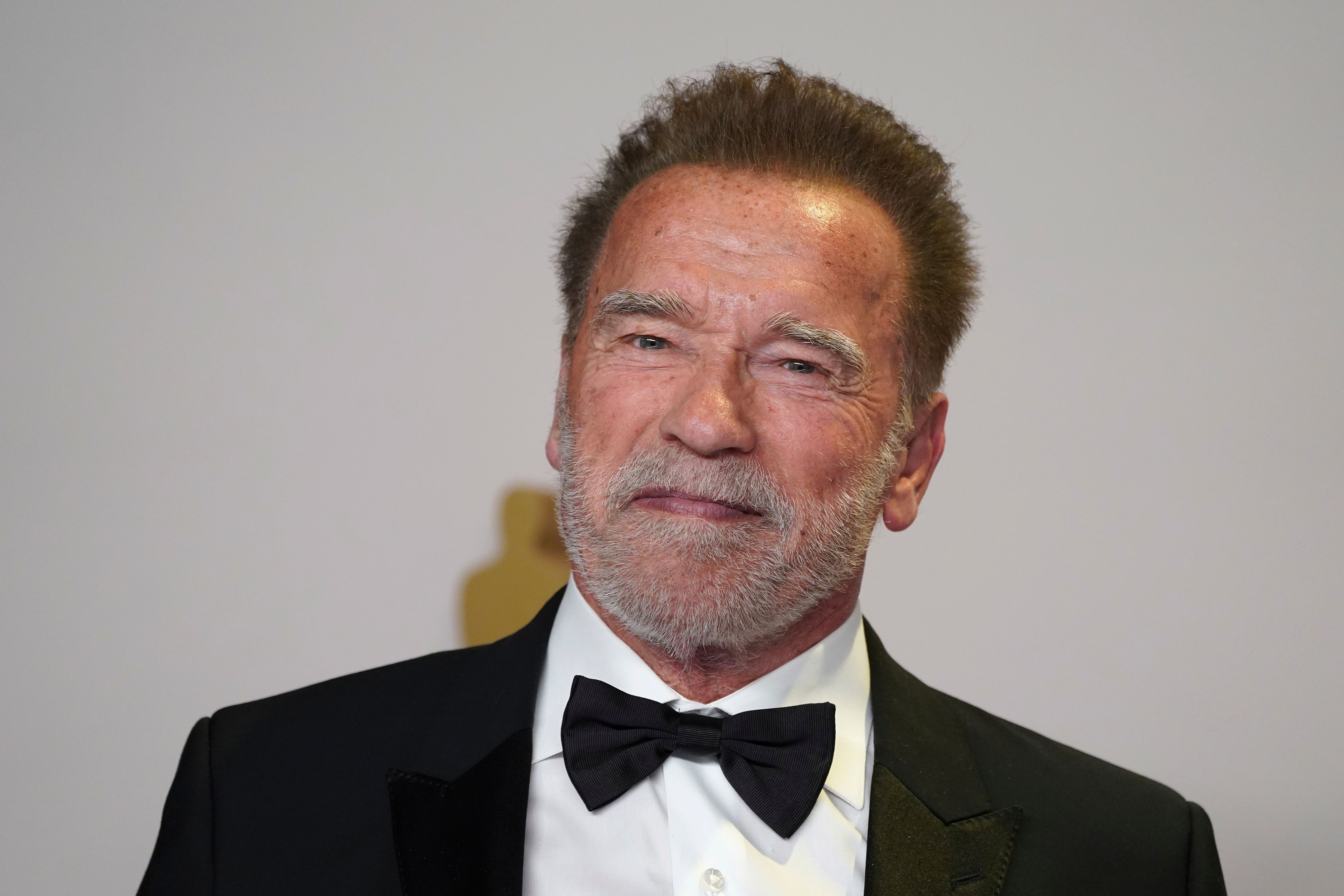 Arnold Schwarzenegger kam mit einem Herzfehler auf die Welt.