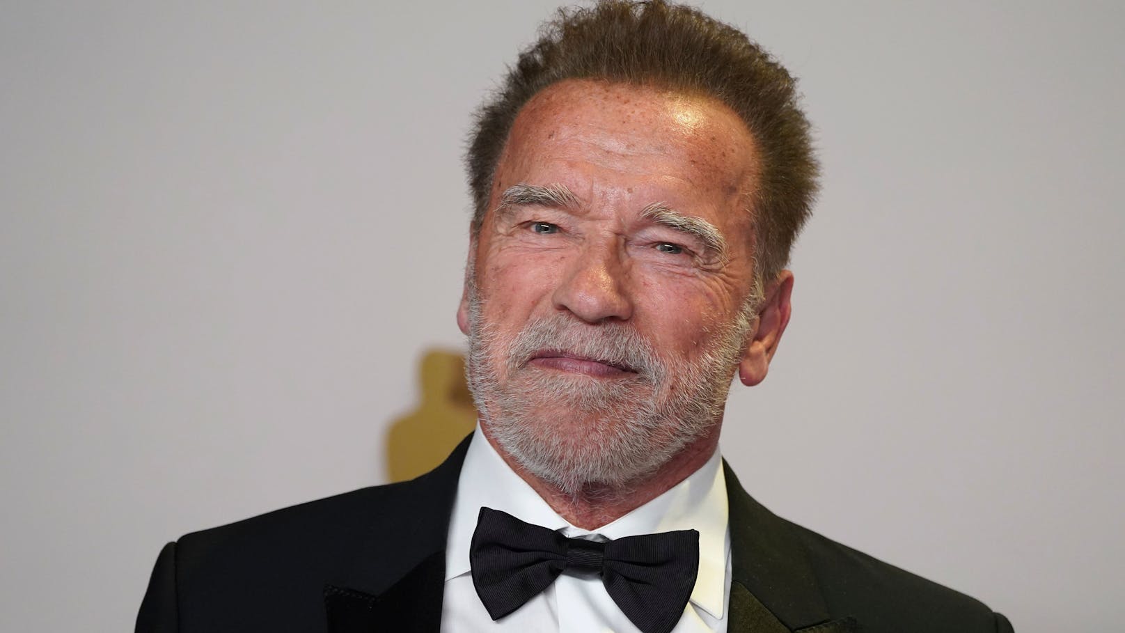 Arnold Schwarzenegger bekam Herzschrittmacher