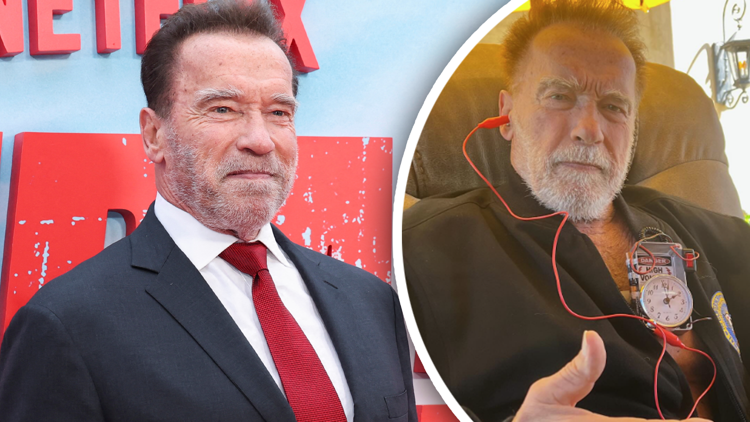Arnold Schwarzenegger hatte eine Herz-OP.