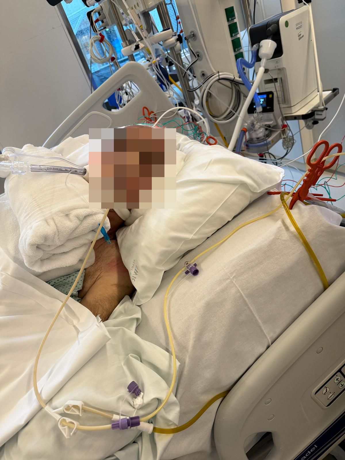 Der Wiener lag lange auf der Intensivstation, soll nun operiert werden.