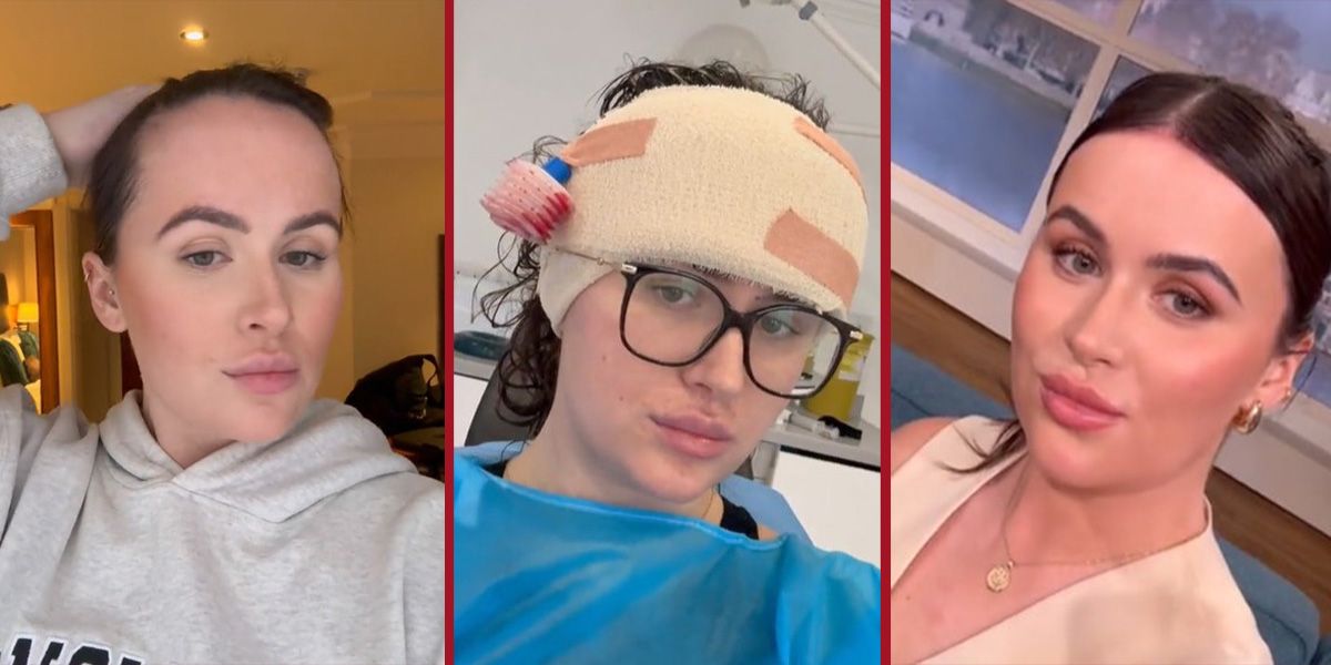 Beth Halsey vor (li.) und nach der OP.&nbsp;