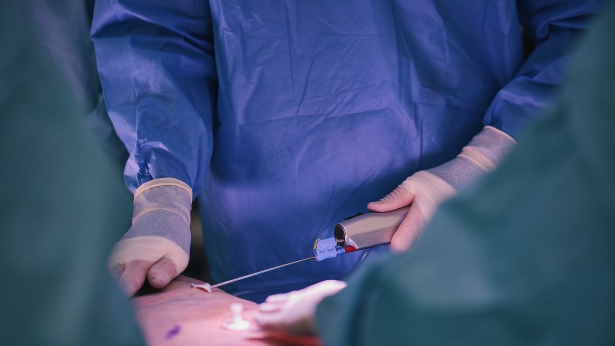 High definition liposuction in the operating room, plastic surgeons, plastic surgery