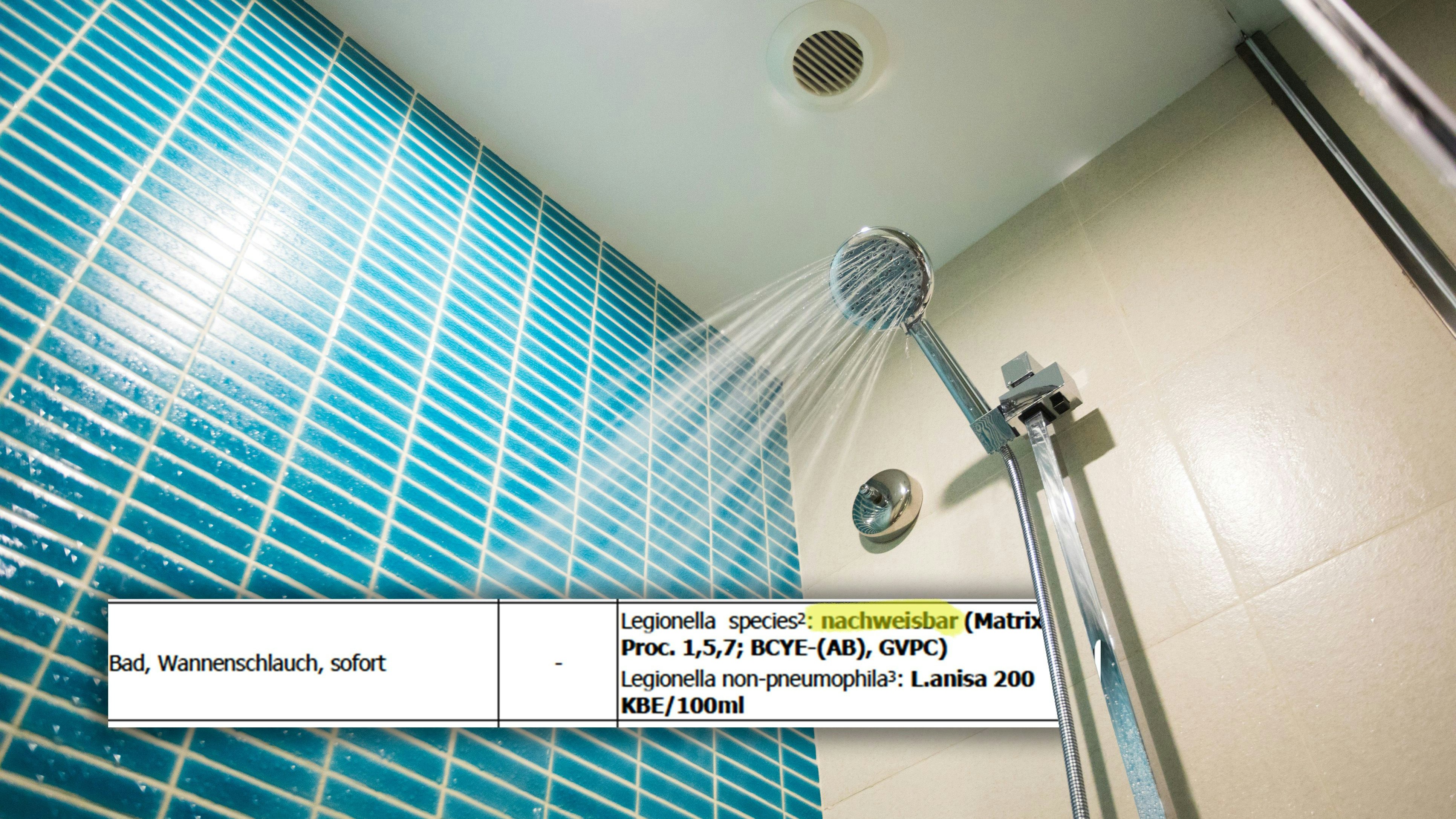 Legionellen im Dischschlauch