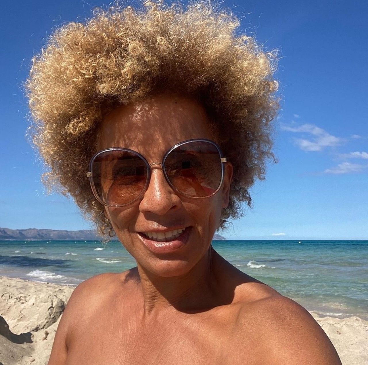 Arabella Kiesabuer tankt im Mallorca-Urlaub Energie. Nach ihrer Operation am Bein geht es wieder 