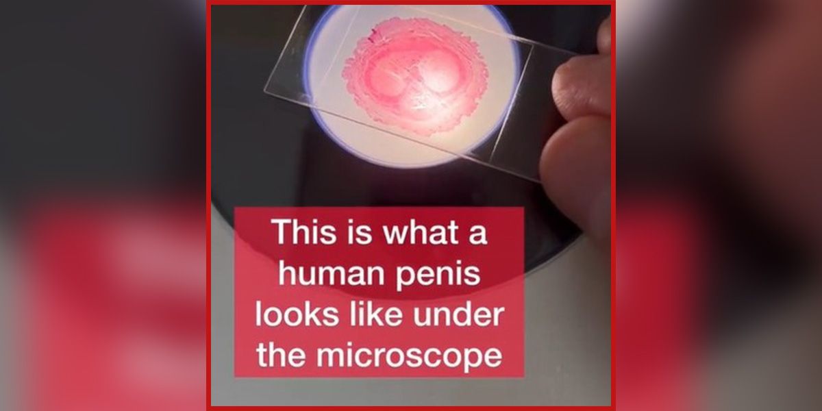 Der Penis ist in drei Kammern unterteilt (Bild).