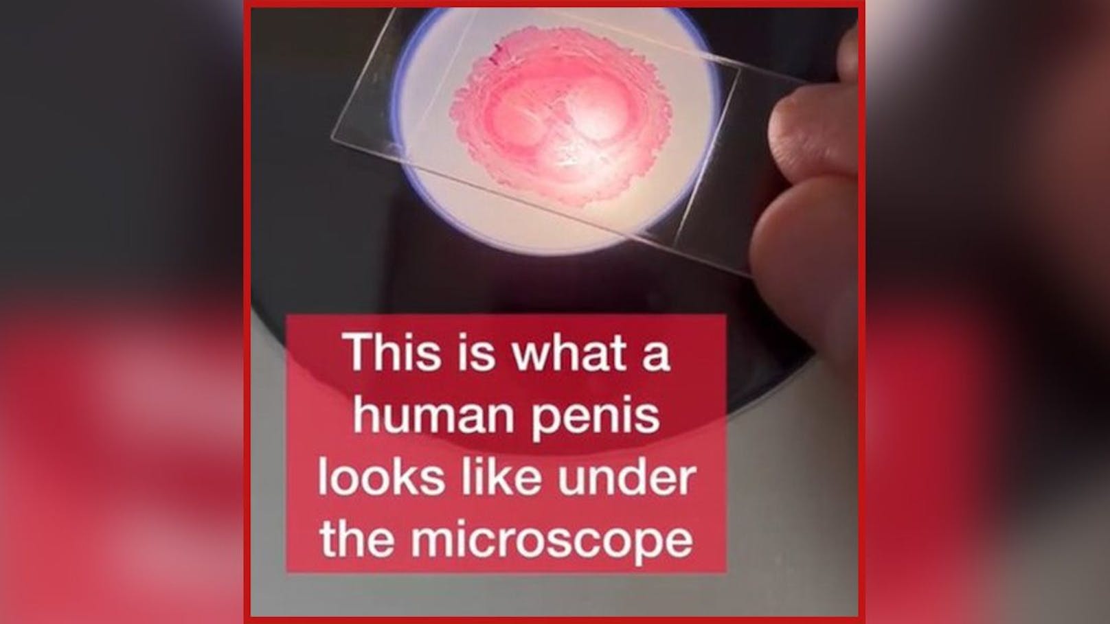 So sieht eine Scheibe Penis unter dem Mikroskop aus