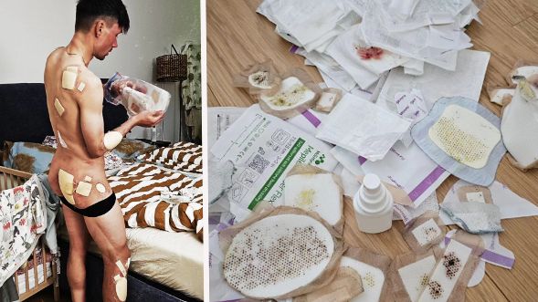 Primož Roglič ist vom Sturz schwer gezeichnet.