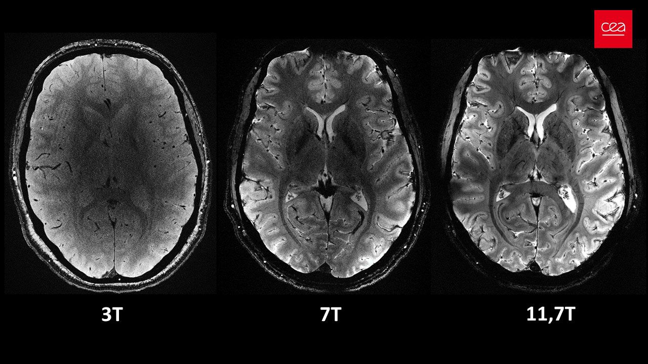  Axial view of the human brain, with the same acquisition time but different magnetic field strengths.