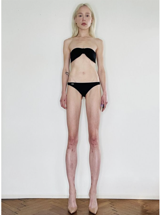 Theresia ist heute 1,84 Meter anstatt 1,70 Meter groß.