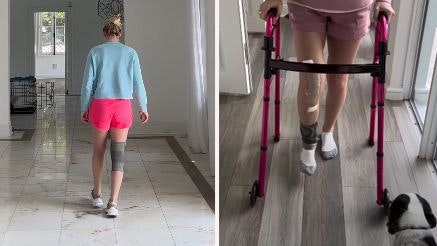 Lindsey Vonn nach der schweren Knie-OP.