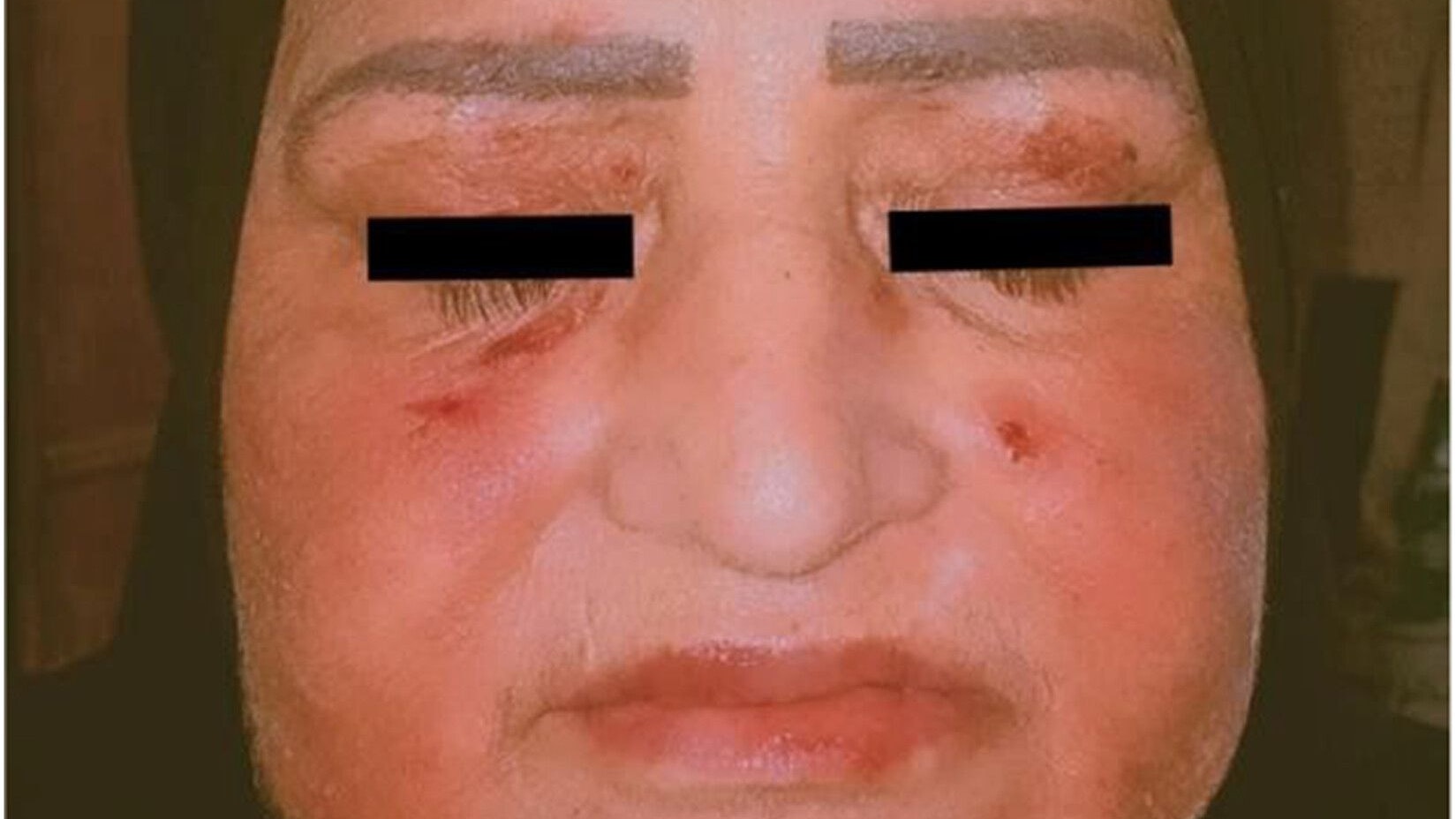 Nach 2 Monaten hatte sich die Frau deutlich erholt.