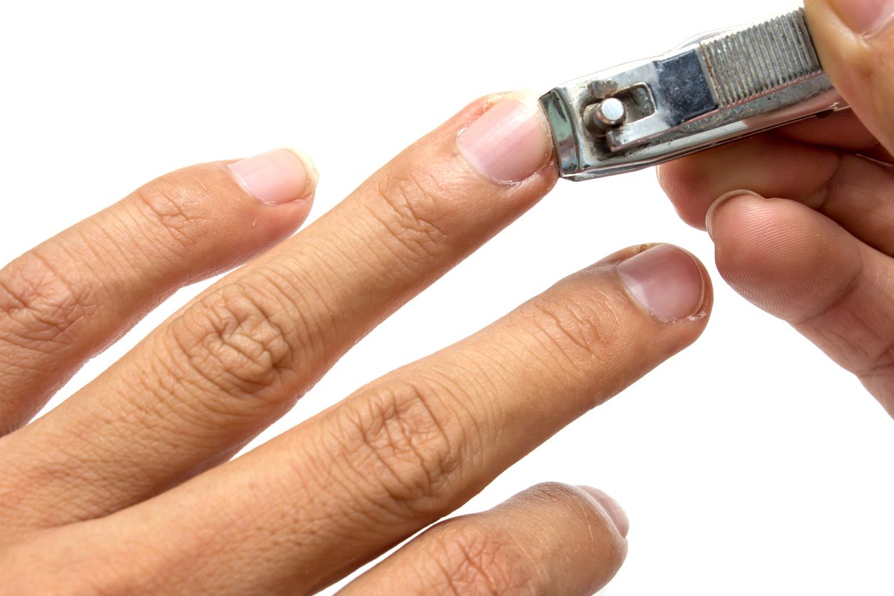 Neben der Nagelschere oder der Nagelzange ist der Nagelknipser (Bild) ein weiteres Werkzeug zum Kürzen der Fuß- und Fingernägel.