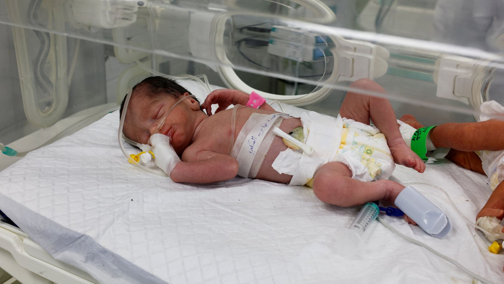 Die kleine Sabreen wurde in der Nacht auf den 21. April 2024 in einem Spital in Gaza per Notkaiserschnitt geboren. Der Rest ihrer Familie kam beim israelischen Luftangriff ums Leben.