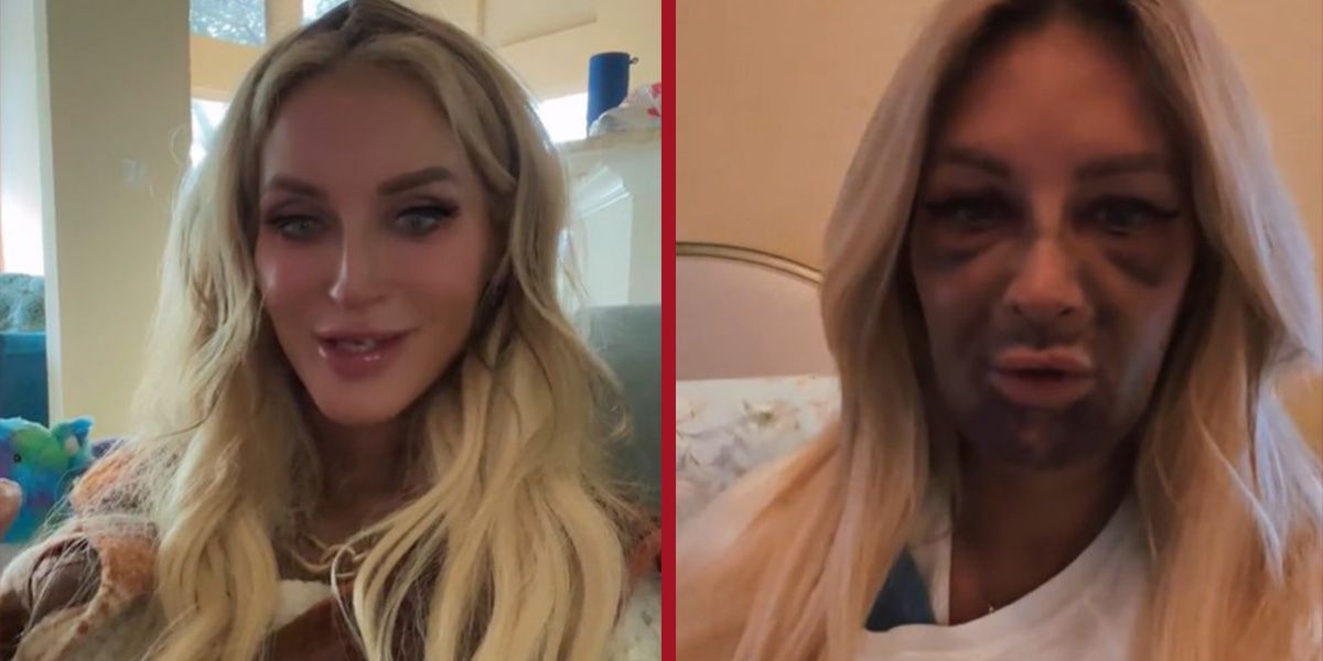 Jessica Macko vor und nach der Behandlung.